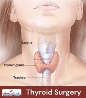 What is Thyroid Surgery