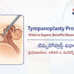 Tympanoplasty Procedure: What…