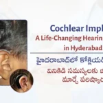Cochlear Implant: A…