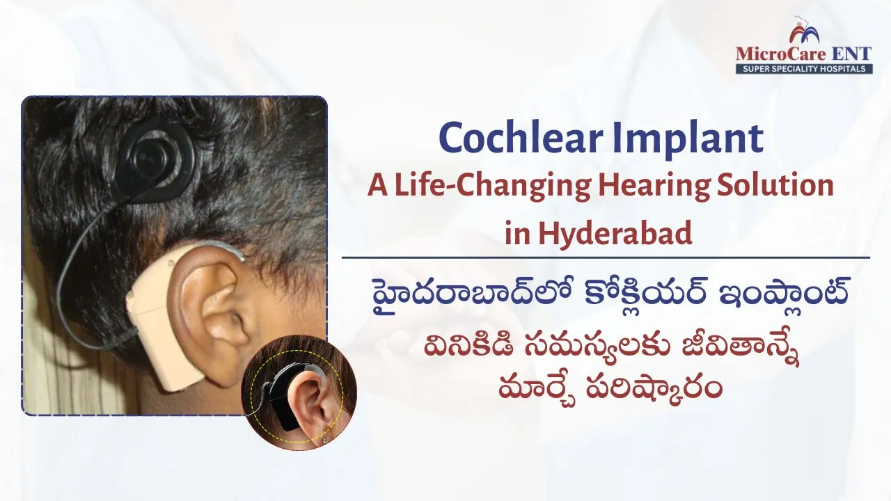 Cochlear Implant in Hyderabad - MicroCare ENT Super Speciality Hospitals