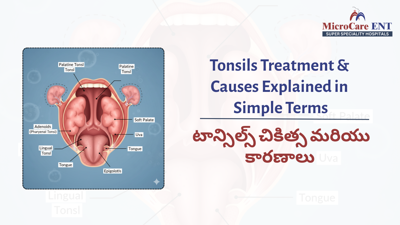Tonsils Treatment at MicroCare ENT Hospital – Expert Care for Tonsillitis, Sore Throat, and Enlarged Tonsils in Hyderabad