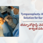 Tympanoplasty: A Permanent&hellip;