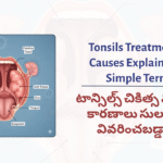 Understanding Tonsils: Causes,…