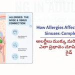 How Allergies Affect…