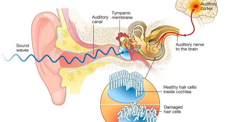 Living with tinnitus dos and don’ts explained by ENT specialists at MicroCare ENT Hospitals Hyderabad Telangana