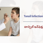 Tonsil Infection Symptoms&hellip;