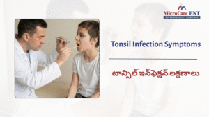 Tonsillitis symptoms and causes explained by ENT specialist at MicroCare ENT Hospital Hyderabad Kukatpally Telangana