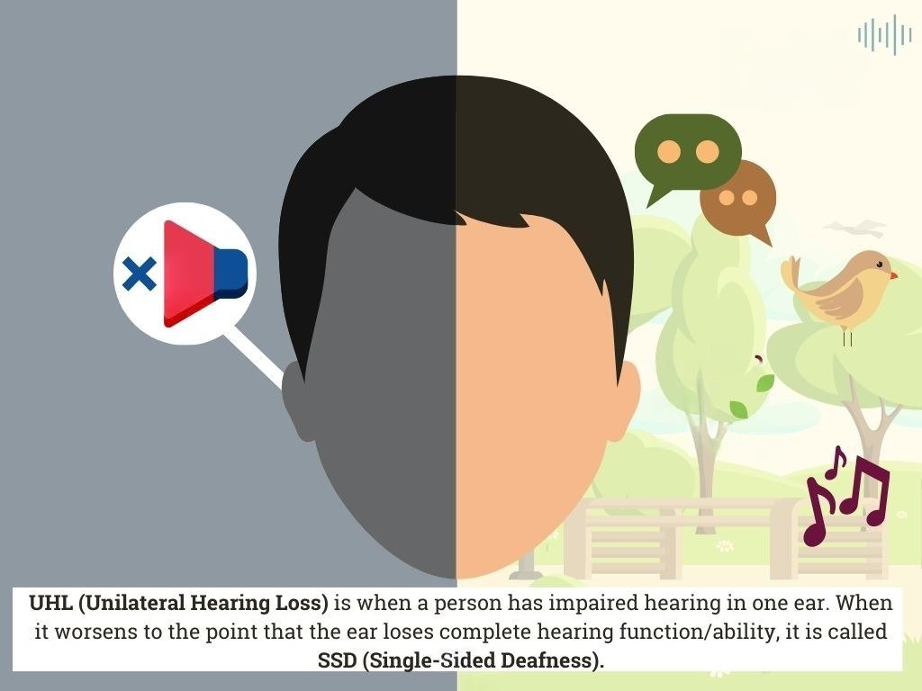 Single-sided deafness (SSD) cochlear implant evaluation at MicroCare ENT Hospitals in Hyderabad, Telangana