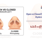 Open vs Closed&hellip;