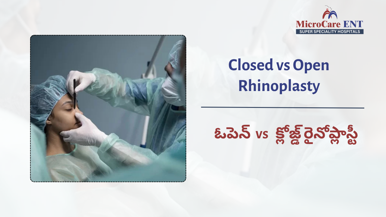Comparison of open and closed rhinoplasty procedures performed by an expert ENT rhinoplasty surgeon at MicroCare ENT Hospital in Hyderabad.