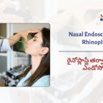 Nasal Endoscopy After&hellip;