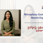 Rhinoplasty in Hyderabad&hellip;