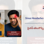 Sinus Headache vs&hellip;