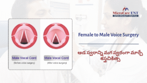 ENT specialist voice surgery Hyderabad vocal cord treatment