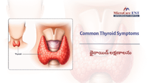 ENT doctor checking thyroid swelling patient Hyderabad