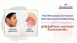 patient breathing comfortably after rhinoplasty Hyderabad