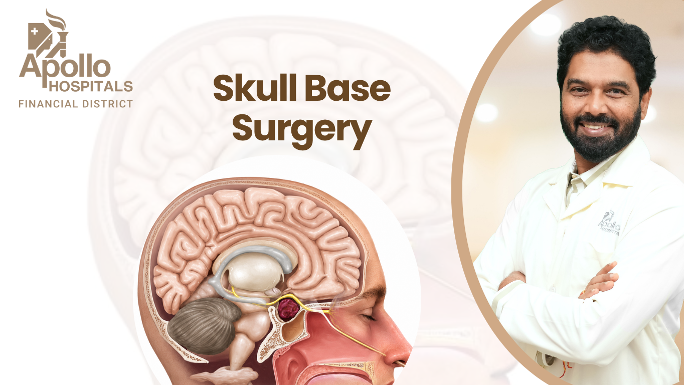 Skull base and pituitary surgery in Hyderabad