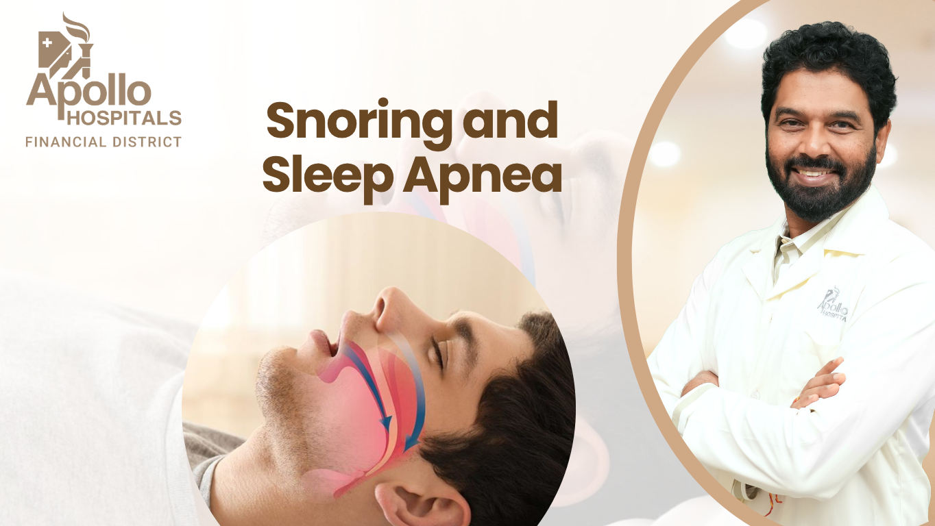 Snoring and sleep apnea treatment in Hyderabad