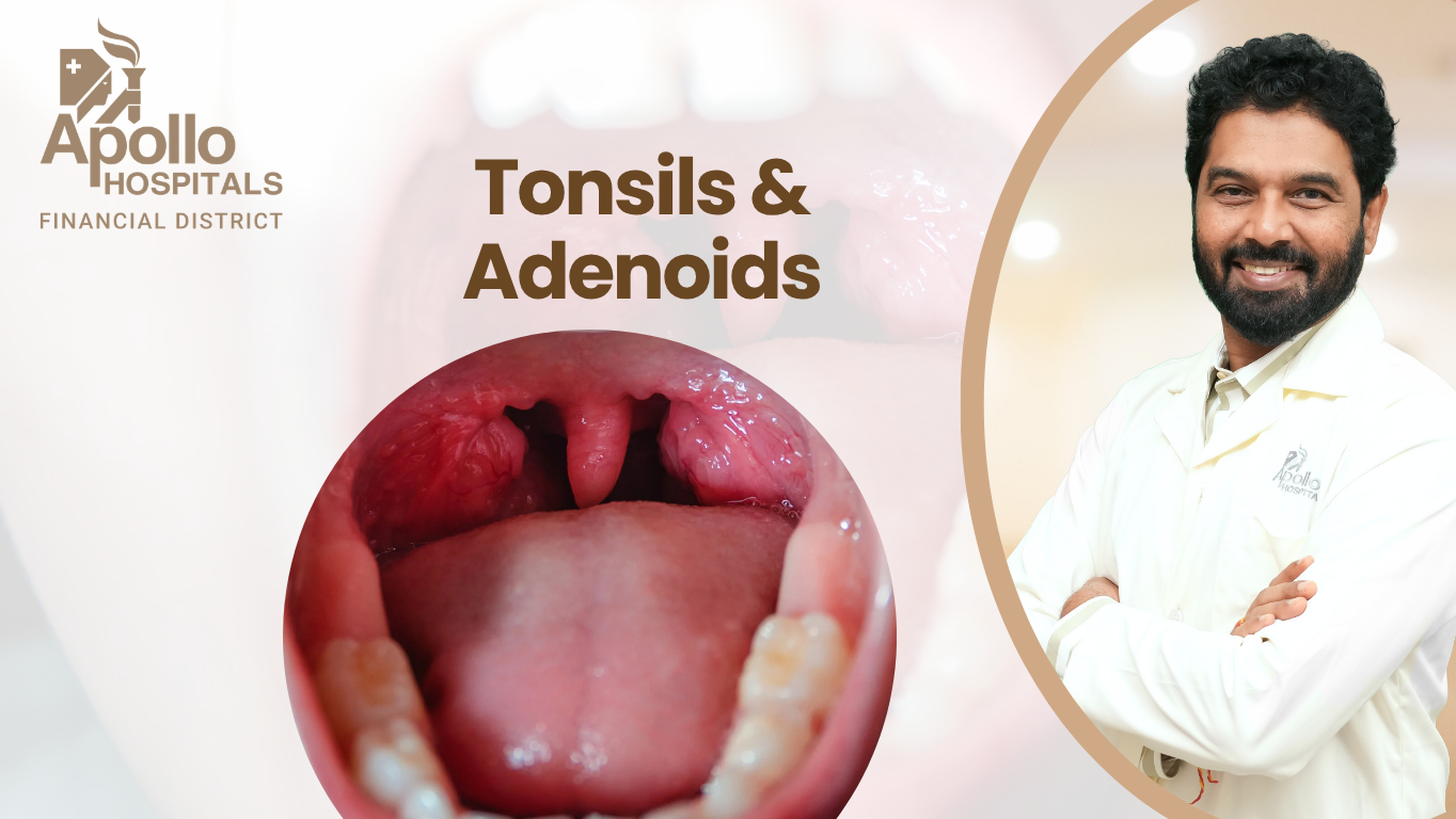 Tonsils and adenoid surgery in Hyderabad