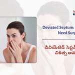 Deviated Septum: When&hellip;
