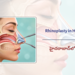 Rhinoplasty in Hyderabad:…