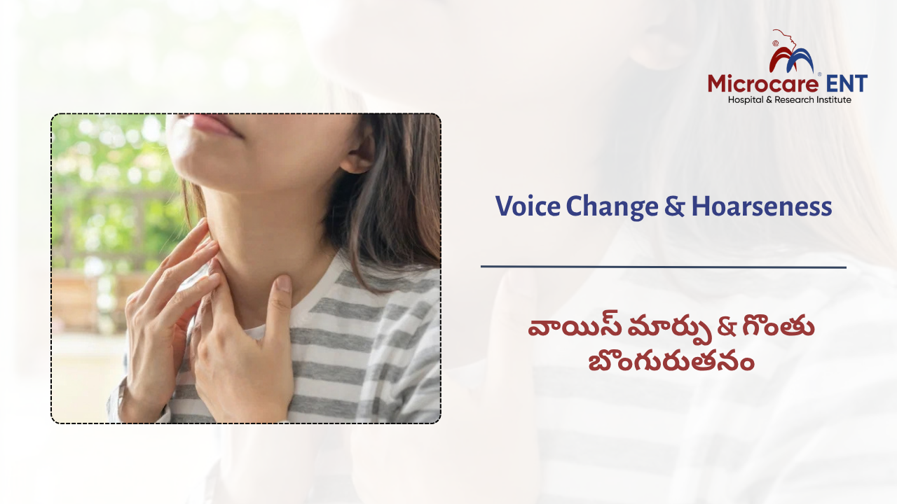 Voice Change and Hoarseness Treatment at MicroCare ENT Hospital Hyderabad