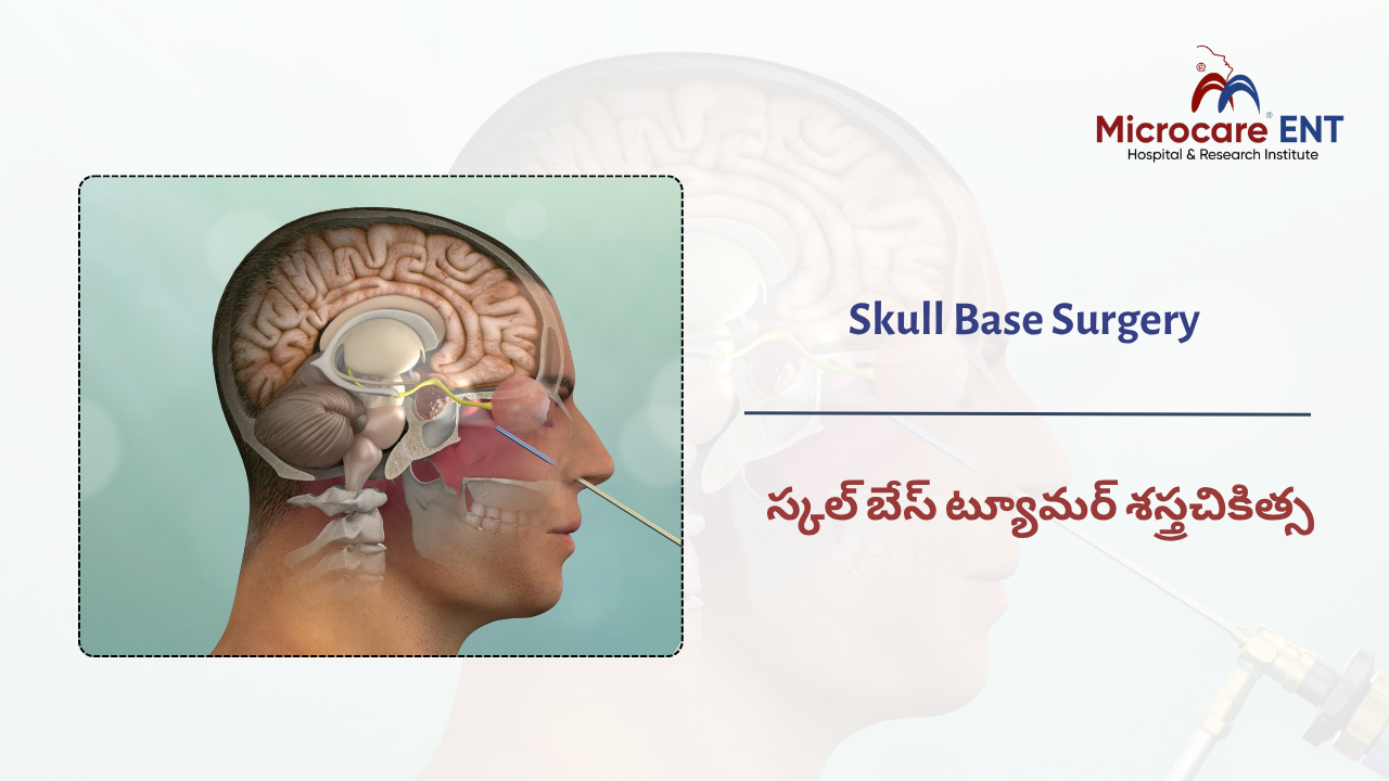 Endoscopic Skull Base Surgery in Hyderabad at MicroCare ENT Hospital Kukatpally