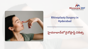 Rhinoplasty in Hyderabad for nose reshaping and functional nasal correction at MicroCare ENT Hospital